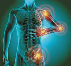 Joint Pain Skeleton